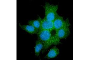 IF analysis of TGFBR2 using anti-TGFBR2 antibody (ABIN6719534).