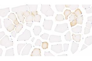 Detection of ALOX15 in Human Skeletal muscle Tissue using Monoclonal Antibody to Arachidonate-15-Lipoxygenase (ALOX15)