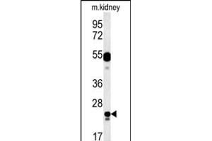 LYSMD1 Antibody (C-term) (ABIN651931 and ABIN2840459) western blot analysis in mouse kidney tissue lysates (15 μg/lane). (LYSMD1 anticorps  (C-Term))
