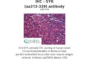 Image no. 1 for anti-Spleen tyrosine Kinase (SYK) (AA 313-339) antibody (ABIN1739810) (SYK anticorps  (AA 313-339))