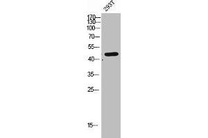 Western Blot analysis of 293T cells using CLN5 Polyclonal Antibody (CLN5 anticorps  (Internal Region))
