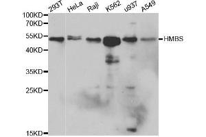 Western blot analysis of extracts of various cell lines, using HMBS antibody. (HMBS anticorps  (AA 1-361))