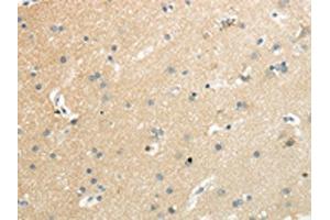 The image on the left is immunohistochemistry of paraffin-embedded Human brain tissue using ABIN7192521(SLC7A11 Antibody) at dilution 1/35, on the right is treated with synthetic peptide. (SLC7A11 anticorps)
