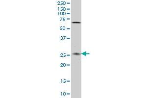 CNO monoclonal antibody (M02), clone 6C3 Western Blot analysis of CNO expression in HeLa . (BLOC1S4 anticorps  (AA 108-217))