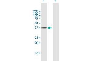 Western Blot analysis of HSP90B1 expression in transfected 293T cell line by HSP90B1 MaxPab polyclonal antibody. (GRP94 anticorps  (AA 1-315))