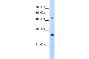 PSME3 antibody used at 1.
