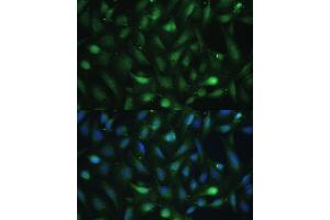 Immunofluorescence analysis of U-2 OS cells using Casein Kinase 2 beta (Casein Kinase 2 beta (CSNK2B)) Polyclonal Antibody (ABIN7266104) at dilution of 1:100 (40x lens).