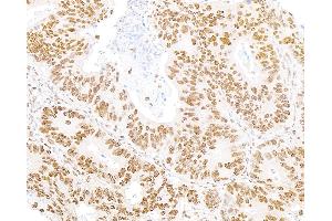 Immunohistochemistry (IHC) image for anti-5'-3' Exoribonuclease 2 (XRN2) (AA 900-950) antibody (ABIN7454718) (XRN2 anticorps  (AA 900-950))