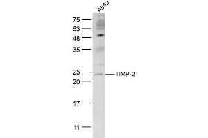anti-Metalloproteinase Inhibitor 2 (TIMP2) (AA 51-150) antibody