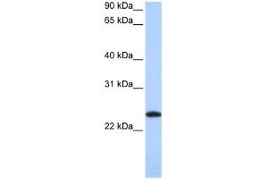 FTL antibody used at 1 ug/ml to detect target protein. (FTL anticorps  (Middle Region))