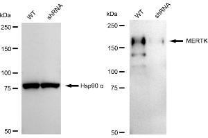 Western blotting analysis using MERTK antibody (ABIN7797812).