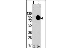 Western blot analysis of RPS6KA1 (arrow) using rabbit polyclonal RPS6KA1 Antibody . (RPS6KA1 anticorps  (AA 710-735))