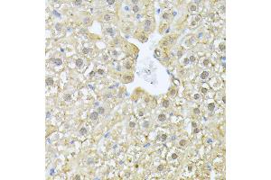Immunohistochemistry of paraffin-embedded mouse liver using PSM antibody (ABIN1682332, ABIN3018467, ABIN3018468 and ABIN6220474) at dilution of 1:100 (40x lens). (PSMA7 anticorps  (AA 1-248))