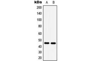 Western blot analysis of 5-HT1A expression in Saos2 (A), Jurkat (B) whole cell lysates. (Serotonin Receptor 1A anticorps  (C-Term))