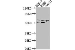Western Blot Positive WB detected in: MCF-7 whole cell lysate, K562 whole cell lysate, HepG2 whole cell lysate All lanes: USP17L3 antibody at 1:1000 Secondary Goat polyclonal to rabbit IgG at 1/50000 dilution Predicted band size: 60 kDa Observed band size: 60 kDa (USP17L3 anticorps  (C-Term))