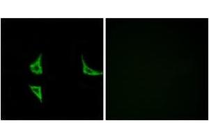 Immunofluorescence analysis of COS7 cells, using CaMK2 (Phospho-Thr286) Antibody. (CAMK2B anticorps  (pThr286))