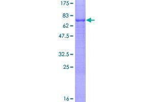 Image no. 1 for Transcription Factor AP-2 delta (Activating Enhancer Binding Protein 2 Delta) (TFAP2D) (AA 1-452) protein (GST tag) (ABIN1322533)