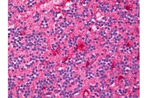 Anti-ENPP2 / Autotaxin antibody IHC of human brain, cerebellum. (ENPP2 anticorps)