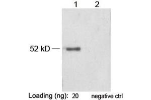 Lane 1: VSV-G-tag fusion protein in Hela cell lysate (~ 52 kD) Lane 2: Negative Hela cell lysateAntibody: 1 µg/mL Rabbit Anti-VSV-G-tag [HRP] Polyclonal Antibody (ABIN398532) The signal was developed with LumiSensorTM HRP Substrate Kit (ABIN769939) (VSV-g Tag anticorps  (HRP))