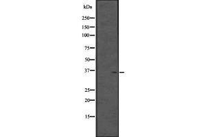 Western blot analysis of CPXCR1 expression in Fetal brain lysate (Human) ;,The lane on the left is treated with the antigen-specific peptide.