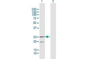 Western Blot analysis of MRPL12 expression in transfected 293T cell line by MRPL12 MaxPab polyclonal antibody. (MRPL12 anticorps  (AA 1-198))
