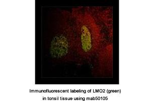 Image no. 1 for anti-LIM Domain Only 2 (Rhombotin-Like 1) (LMO2) antibody (ABIN363259)