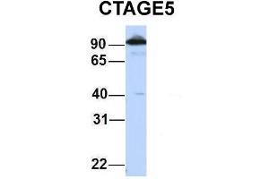 Host:  Rabbit  Target Name:  CTAGE5  Sample Type:  HepG2  Antibody Dilution:  1. (MIA2 anticorps  (Middle Region))