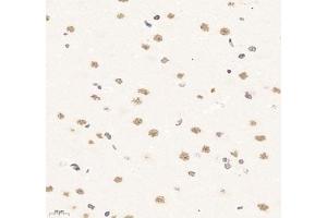 Immunohistochemistry of paraffin embedded rat brain using SUPT3H (ABIN7075767) at dilution of 1: 1500 (400x lens) (SUPT3H/SPT3 anticorps)