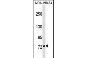 CUX1 Antibody (C-term) (ABIN1537517 and ABIN2850213) western blot analysis in MDA-M cell line lysates (35 μg/lane). (CUX1 anticorps  (C-Term))