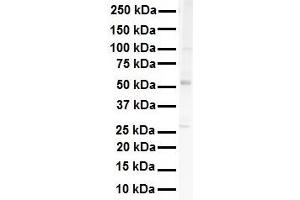 WB Suggested Anti-SNRP70 antibody Titration: 1 ug/mL Sample Type: HEK293