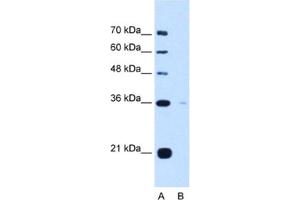 Western Blotting (WB) image for anti-Torsin Family 1, Member B (Torsin B) (TOR1B) antibody (ABIN2463038)