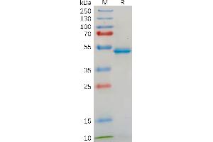 Interleukin 18 (IL18) (AA 37-197) protein (Fc Tag)