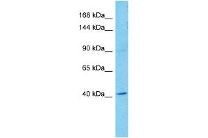 Host:  Rabbit  Target Name:  OSMR  Sample Tissue:  Human A549 Whole Cell  Antibody Dilution:  1ug/ml (Oncostatin M Receptor anticorps  (N-Term))