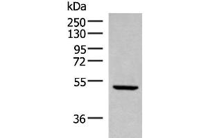 Western blot analysis of Rat heart tissue lysate using PSMD12 Polyclonal Antibody at dilution of 1:300 (PSMD12 anticorps)