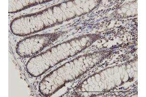 Immunoperoxidase of monoclonal antibody to RPL14 on formalin-fixed paraffin-embedded human colon.