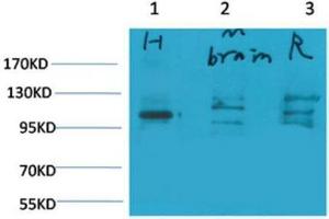Western Blot (WB) analysis of 1) Human Brain Tissue, 2)Mouse Brain Tissue, 3) Rat Brain Tissue with Glutamate Receptor 1 Rabbit Polyclonal Antibody diluted at 1:2000. (Glutamate Receptor 1 anticorps)