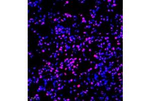 Immunofluorescence of paraffin embedded mouse lung using TFIIIC110 (ABIN7074038) at dilution of 1:650 (400x lens)