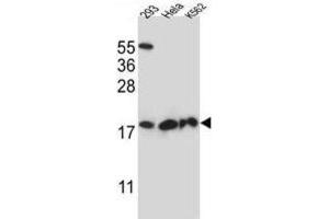 Western Blotting (WB) image for anti-Dihydrofolate Reductase-Like 1 (DHFRL1) antibody (ABIN2997304) (DHFRL1 anticorps)