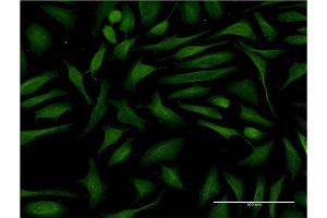 Immunofluorescence of monoclonal antibody to JMY on HeLa cell.