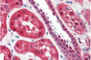 ABIN334342 (2µg/ml) staining of paraffin embedded Human Kidney.