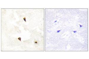 Immunohistochemistry (IHC) image for anti-Tumor Protein P53 Inducible Protein 11 (TP53I11) (Internal Region) antibody (ABIN1848934) (TP53I11 anticorps  (Internal Region))