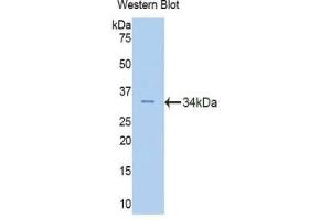 Western blot analysis of the recombinant protein. (Fascin 2 anticorps  (AA 8-278))
