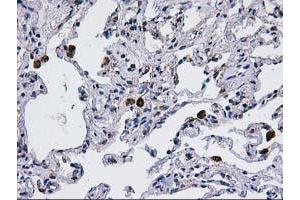 Immunohistochemical staining of paraffin-embedded Human lung tissue using anti-CCM2 mouse monoclonal antibody. (CCM2 anticorps)