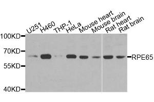 Western blot analysis of extracts of various cell lines, using RPE65 antibody (ABIN6003573) at 1/1000 dilution. (RPE65 anticorps)