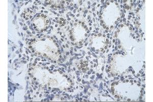 Rabbit Anti-KIAA0020 Antibody       Paraffin Embedded Tissue:  Human alveolar cell   Cellular Data:  Epithelial cells of renal tubule  Antibody Concentration:   4. (KIAA0020 anticorps  (N-Term))