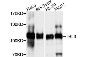 Western blot analysis of extracts of various cells, using TBL3 antibody. (TBL3 anticorps)