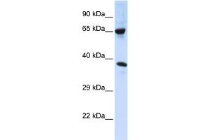 WB Suggested Anti-C6orf134 Antibody Titration:  0. (Chromosome 6 Open Reading Frame 134 (C6orf134) (Middle Region) anticorps)