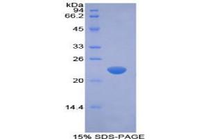 SDS-PAGE analysis of Rabbit Interferon beta Protein. (IFNB1 Protéine)