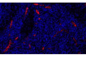 Immunofluorescence (IF) image for anti-Selectin P (Granule Membrane Protein 140kDa, Antigen CD62) (SELP) (AA 42-771) antibody (ABIN7795665)