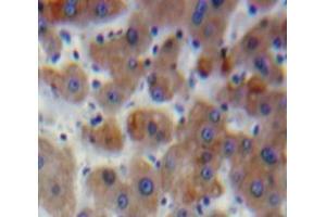 Used in DAB staining on fromalin fixed paraffin-embedded Liver tissue (SERPINB2 anticorps  (AA 68-313))